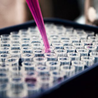 علاج العقم وأطفال الأنابيب IVF